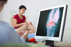 osteoartrīts diagnostika