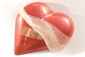 Krūškurvja mugurkaula osteohondroze negatīvi ietekmē sirdi