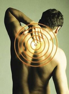Muguras sāpes, kas pastiprinās ieelpojot, ir krūšu kurvja osteohondrozes simptoms