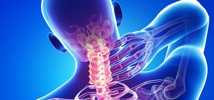 mugurkaula kakla daļas osteohondroze