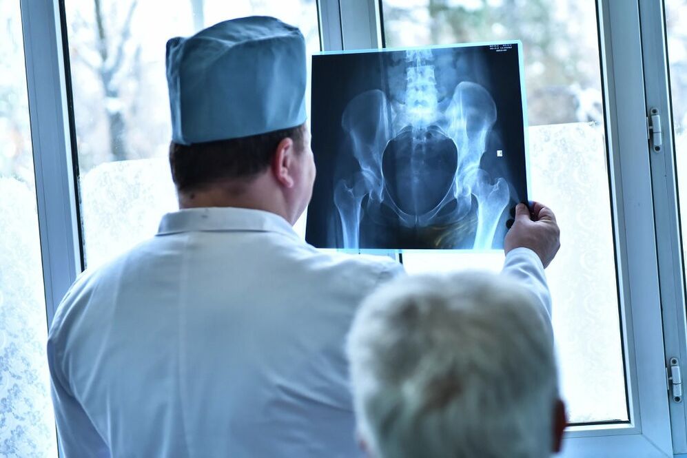 Ārsts apskata attēlu ar gūžas locītavu ar artrozi