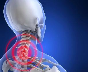 Vieta lokalizācijas sāpes kakla osteohondrozes